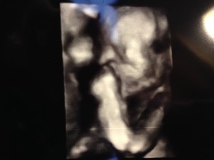 It is a Boy 3D