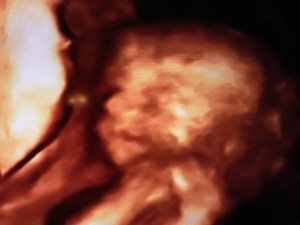 Megans Precious Baby
