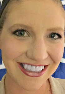 Lovemy Younique